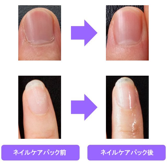 フィンガー&ネイルパックの使用前と使用後
